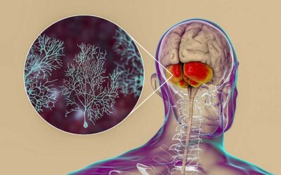 Analizan cómo funciona el cerebro ante temperaturas anormalmente altas