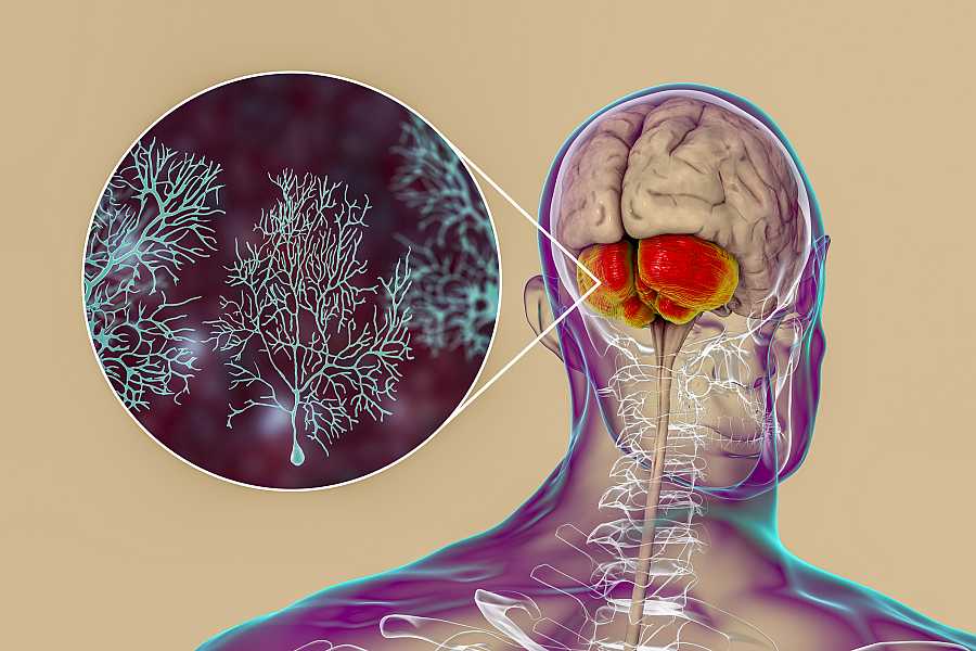 Analizan cómo funciona el cerebro ante temperaturas anormalmente altas