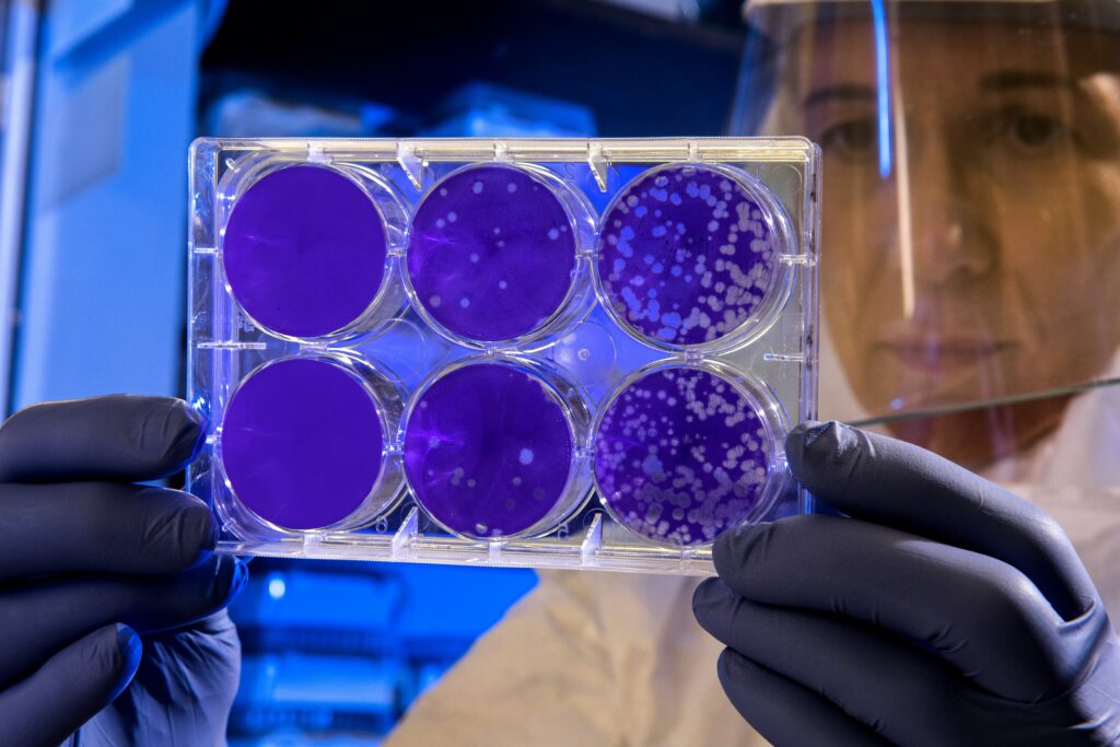 Las bacterias resistentes se vuelven problemáticas en términos de contención de enfermedades e infecciones.