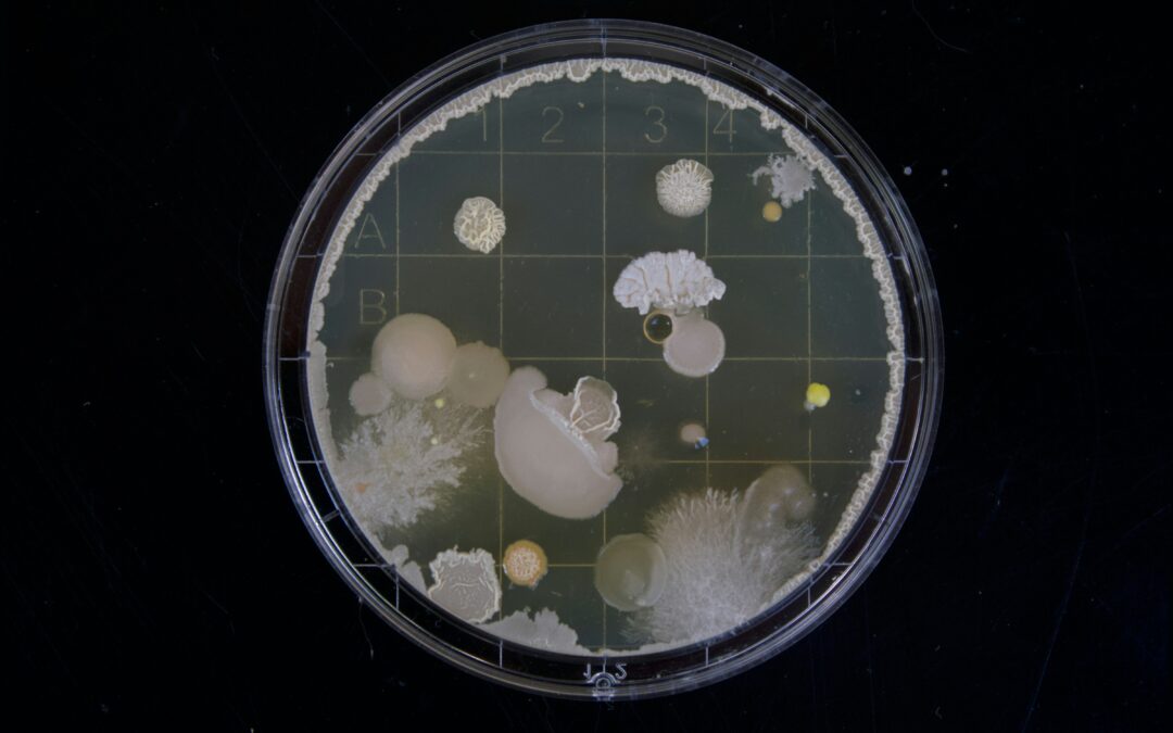 Preocupa el aumento de bacterias resistentes en Argentina